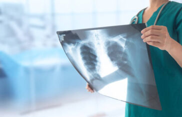 doctor radiologist looking lung x-ray film of patient at hospital.